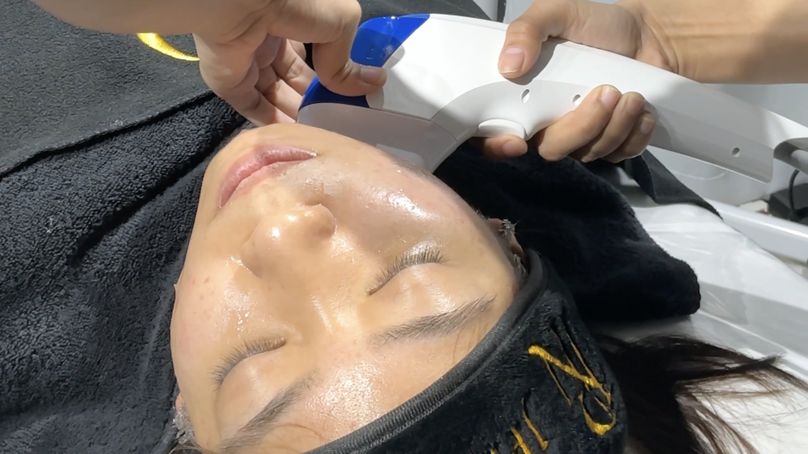 HIFU handpiece on the jawline