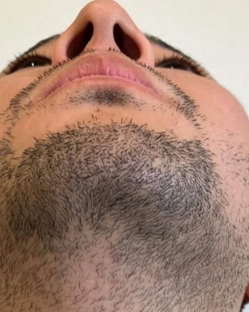 Before treatment